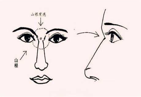 面相图解：山根青黑，年内有灾；女子眼恶，寡居独宿；女子形恶，多夫之相