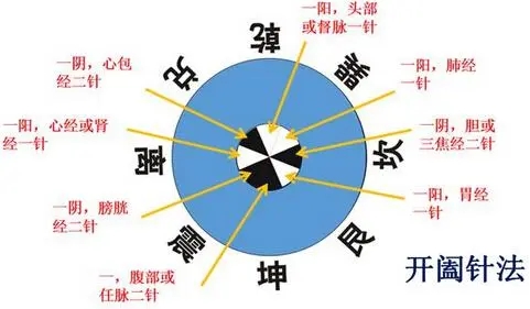 论医易同源之六十四卦咸卦——针石术的萌芽