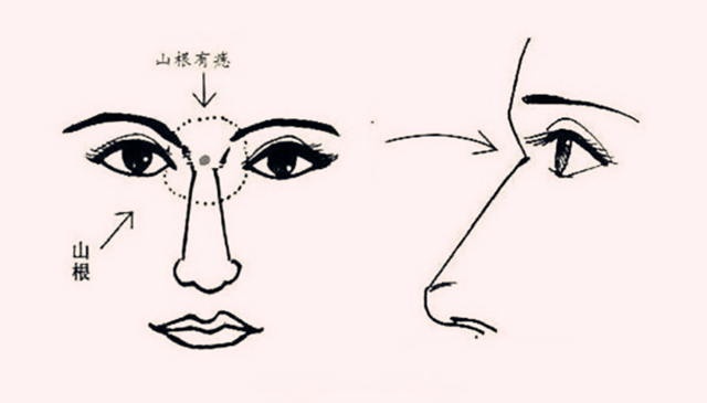 面相图解：山根青黑，年内有灾；女子眼恶，寡居独宿；女子形恶，多夫之相